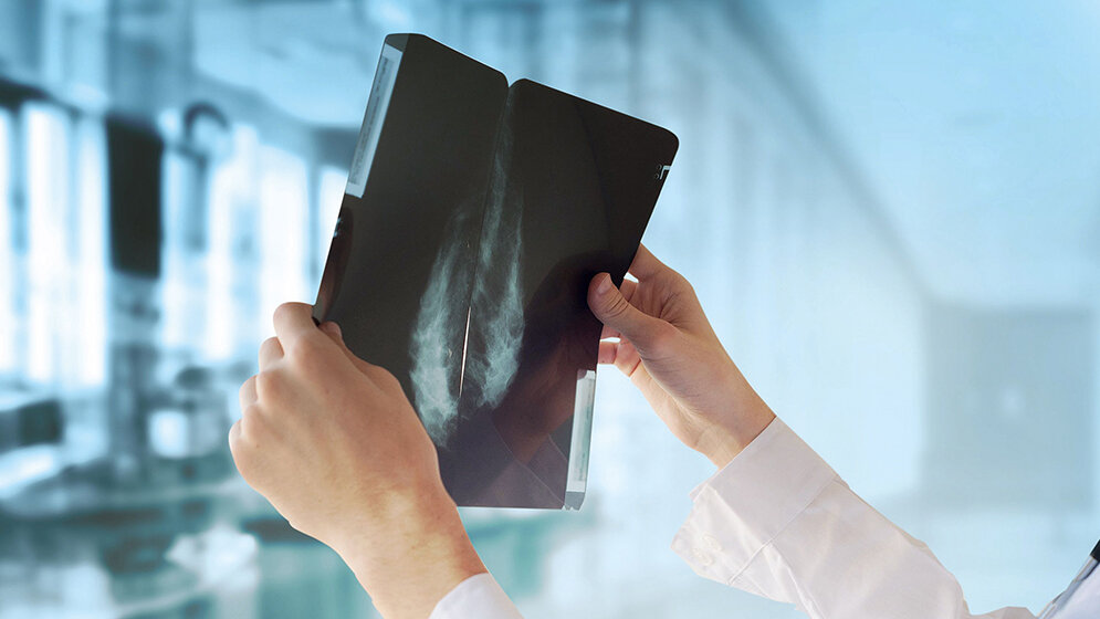 Overdiagnosis – Less is More