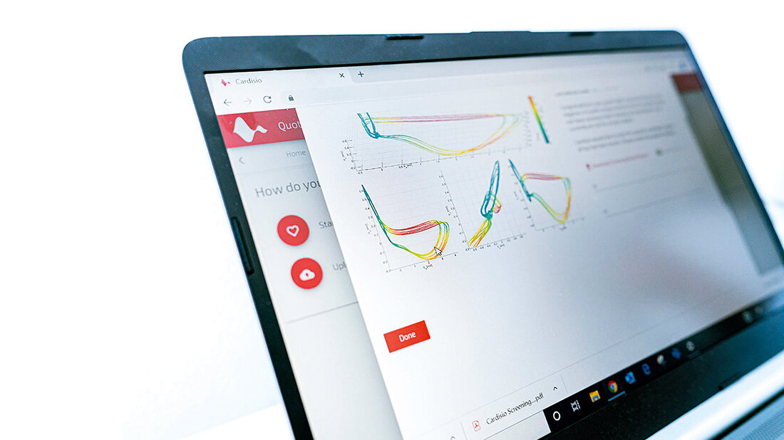 Abbildung zur Vorstellung der „Cardisiografie“