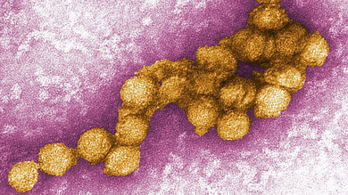 West_Nil_Virus_CDC.jpg West-Nil-Virus