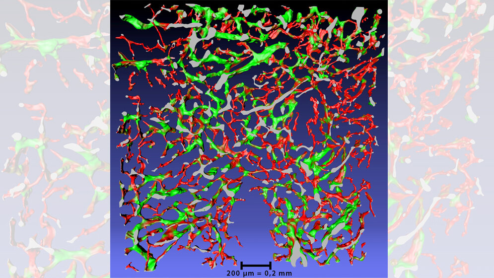 3D_Rekonstruktion_von_Blutgefaessen_im_Knochenmark_Oleg_Lobachev.jpg 3D-Rekonstruktion von Blutgefäßen im Knochenmark