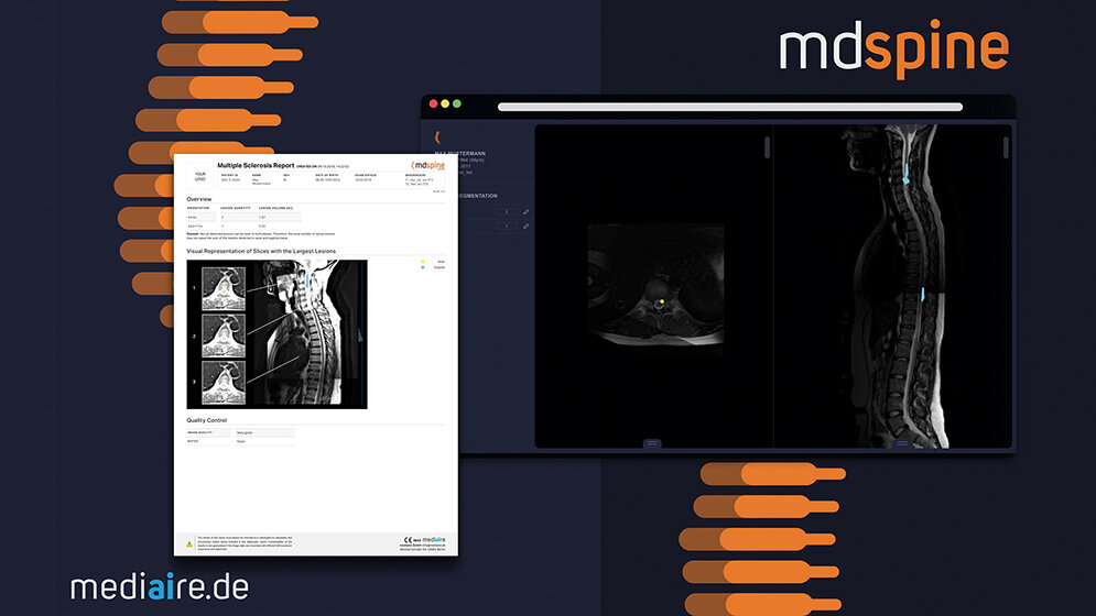 mdspine für die Diagnostik von Rückenmarkserkrankungen