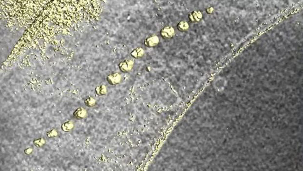 Die magnetischen Nanoteilchen bilden im Innern der Zelle eine Kette