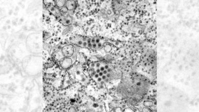 dengue_CDC_Frederick_Murphy.jpg Dengue