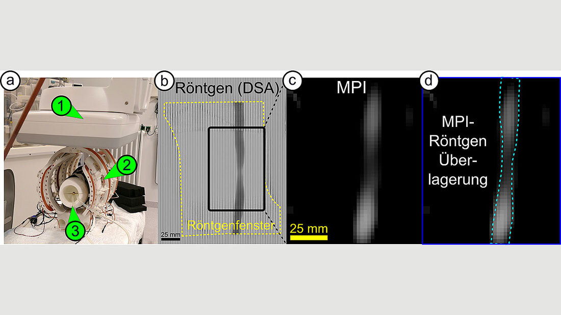 MPI_im_Vergleich.jpg iMPI-Scanner im Vergleich