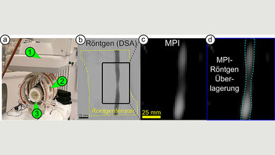 iMPI-Scanner im Vergleich