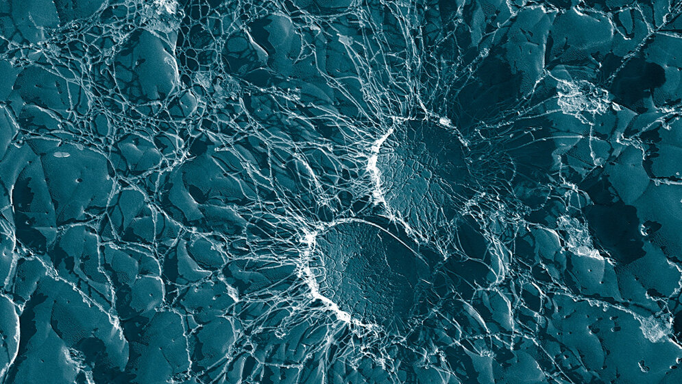 Staphylococcus_aureus_sekundaerelektronenmikroskopische_Aufnahme_Eric_Erbe_Christopher_Pooley_USDA_gemeinfrei.jpg Staphylococcus aureus