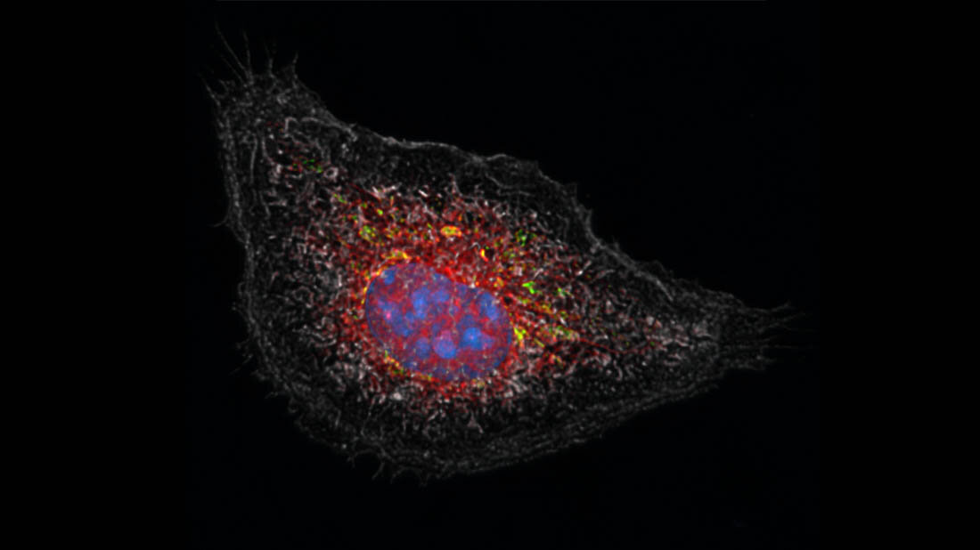 Wirkung_von_Kortison.jpg Eine durch einen Entzündungsreiz aktivierte Fresszelle nach Kortison-Behandlung..