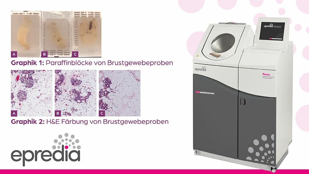 Gewebeverarbeitung von Fettgewebe 