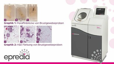 Gewebeverarbeitung von Fettgewebe 