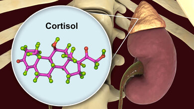 Morbus Addison: Nebenniere und Cortisol sind abgebildet.