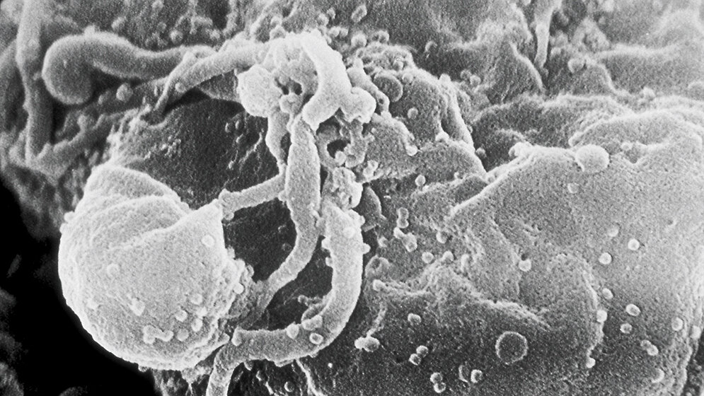 Sonstiges HIV-Patienten auf der Intensivstation