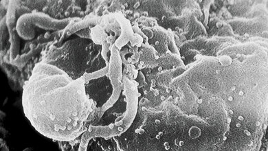 HIV-Patienten auf der Intensivstation