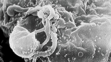 HIV-Patienten auf der Intensivstation