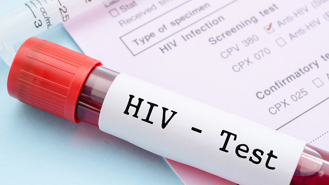 Nahaufnahme eines HIV-Test-Röhrchens mit rotem Deckel, daneben eine Spritze und ein Formular für HIV-Screening-Tests.
