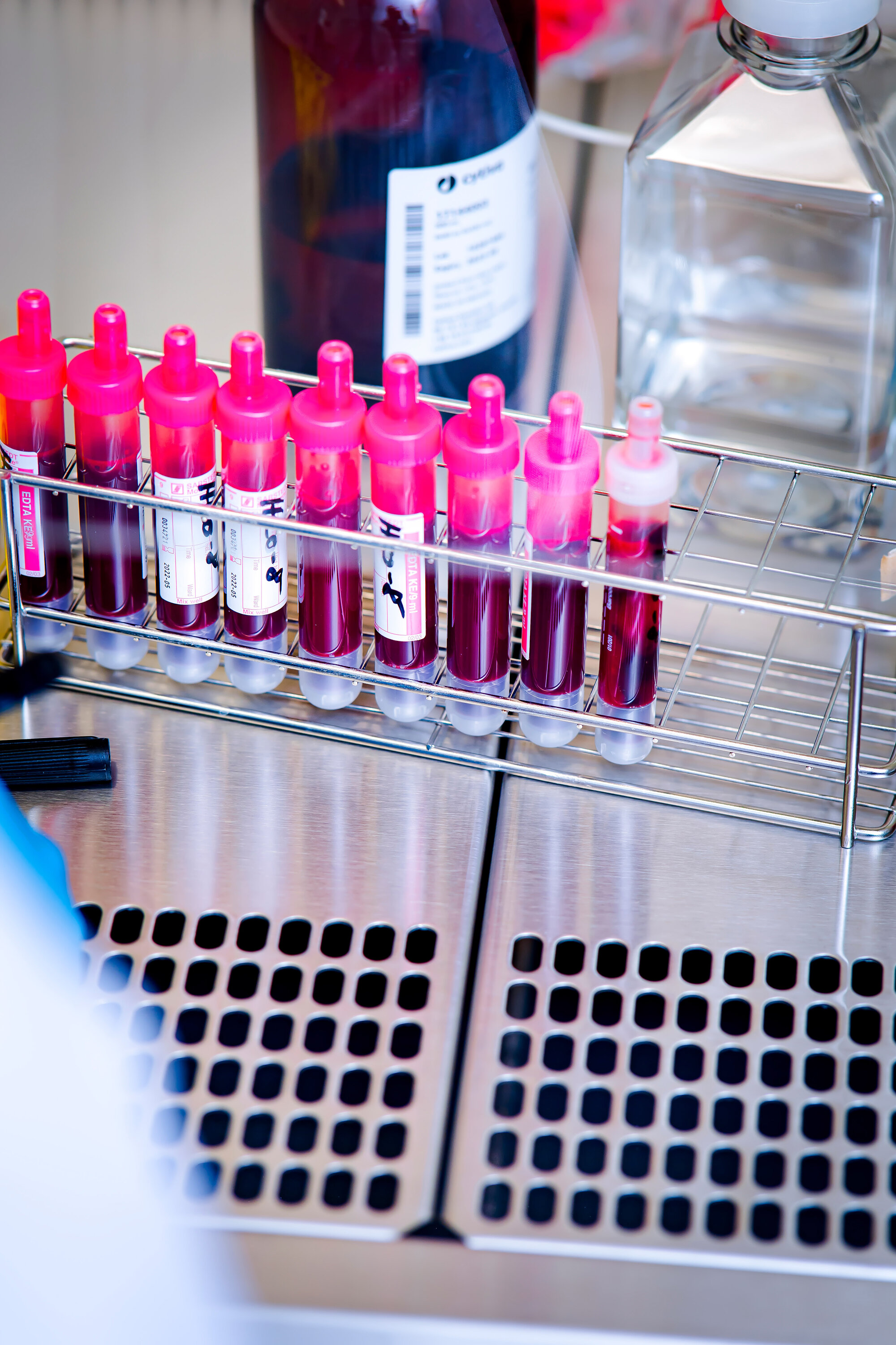 Tryptophan2.jpg Bei 9 von 13 untersuchten chronischen Entzündungserkrankungen waren die Tryptophankonzentrationen im Blut signifikant reduziert.