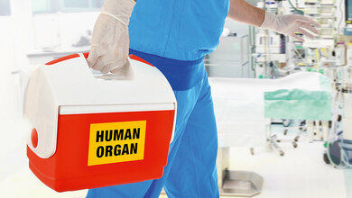 Foto einer Organtransportbox