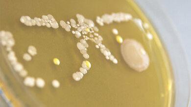 Bakterielle Besiedlung 