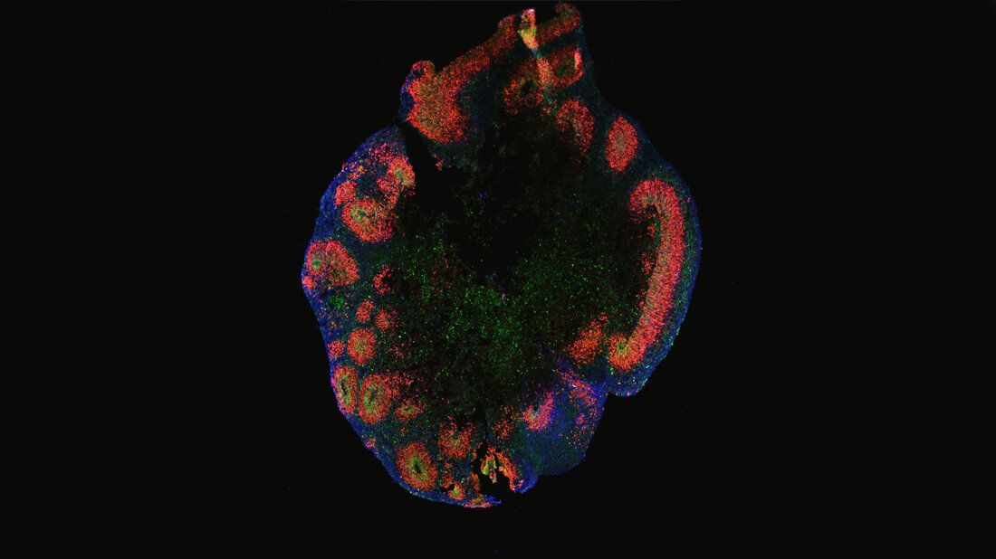 Organoid der menschlichen Großhirnrinde