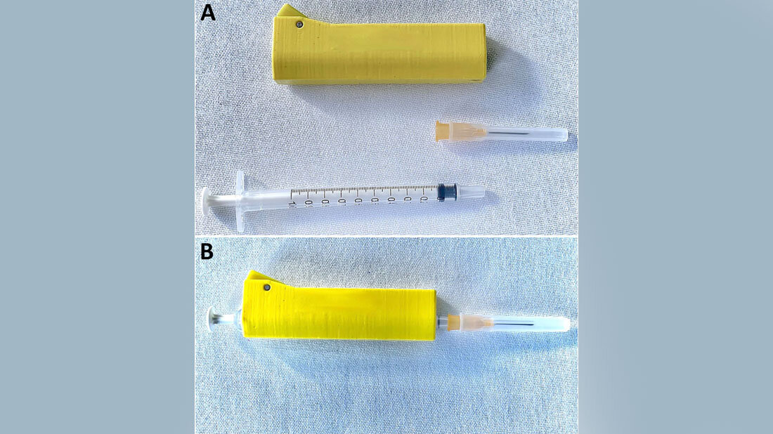 Mit einem Bleischutz versehene Spritze, die während der nosokomialen Übertragung von Plasmodium falciparum-Malaria verwendet wurde.