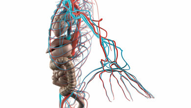 CT Angiografie – Armarterien