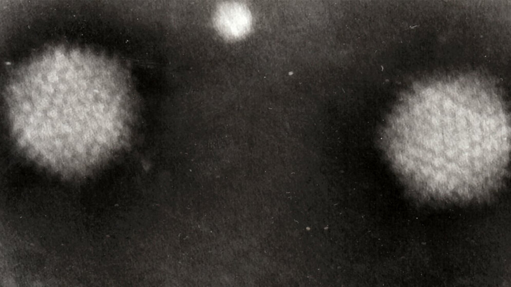 Adenovirus