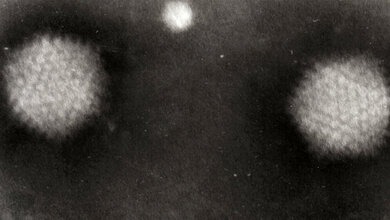 Adenovirus