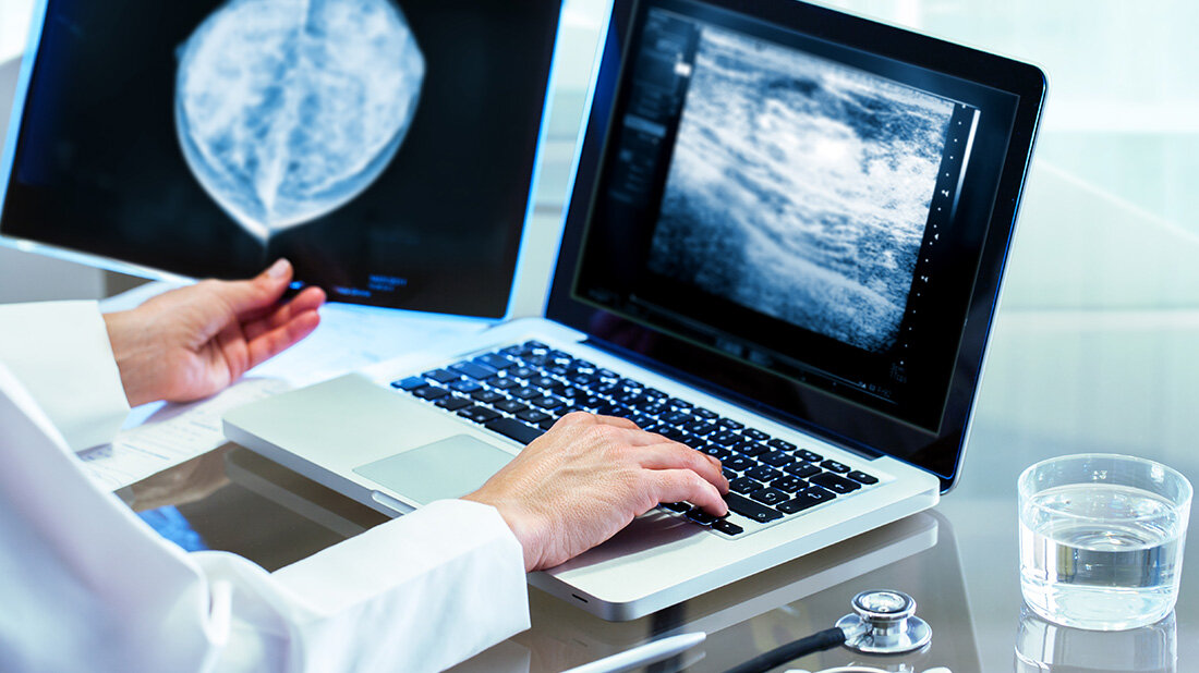 Brustkrebsdiagnostik.jpg Digitale Brust-Tomosynthese besser als Standardmethode?