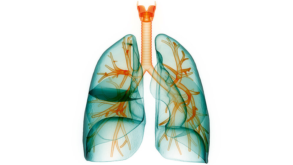 Pneumonie Differenzialdiagnose Endokarditis