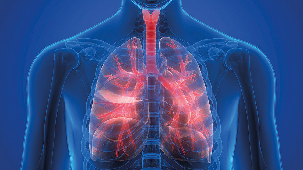 Sarkoidose – Funktionsdiagnostik und COVID-19