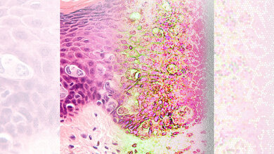 Von einem Gewebeschnitt zu Computer-interpretierbaren Informationen