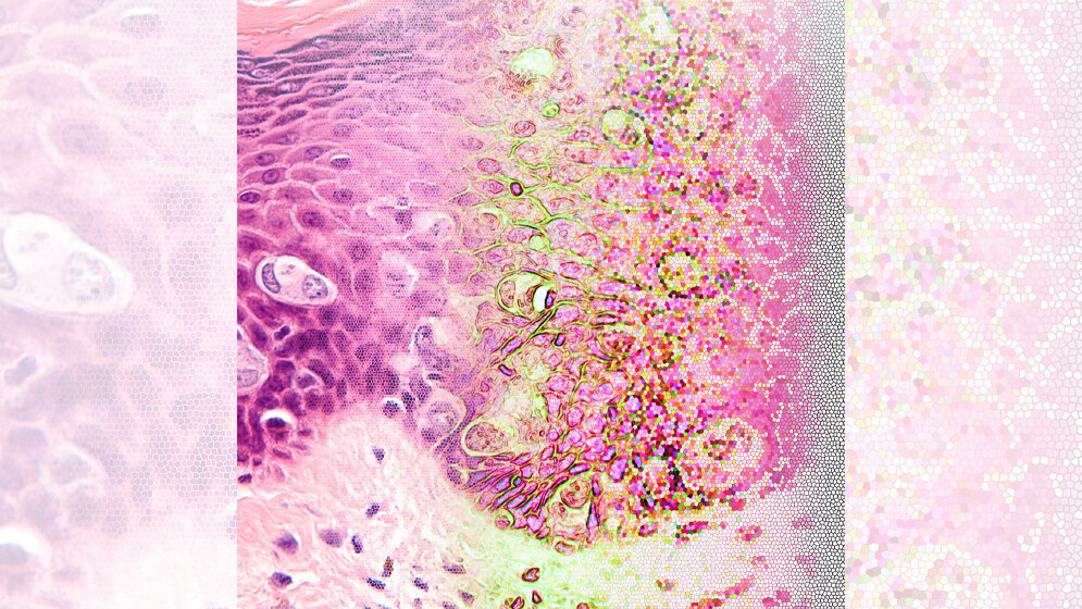Von einem Gewebeschnitt zu Computer-interpretierbaren Informationen