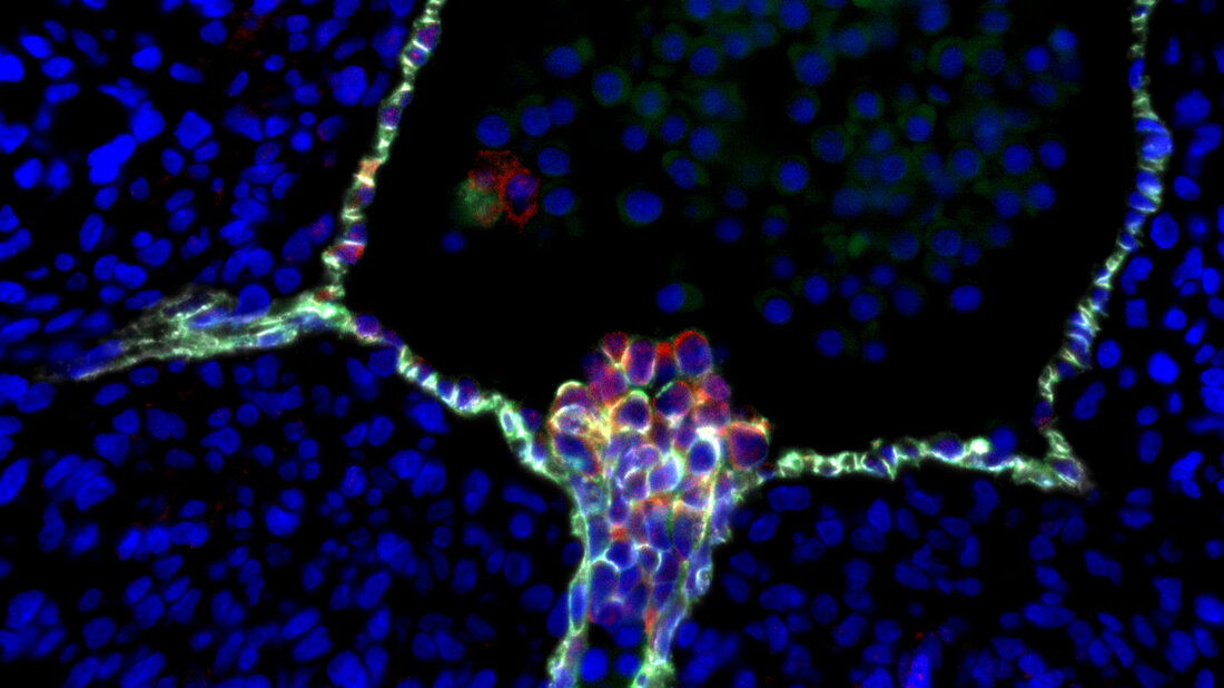 Immunfluoreszenz Färbung eines intra-aorten hämatopoetischen Zellclusters