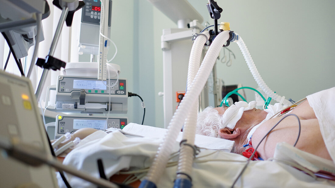 Deformierte rote Blutzellen bei COVID-Patienten mit schwerem Verlauf 