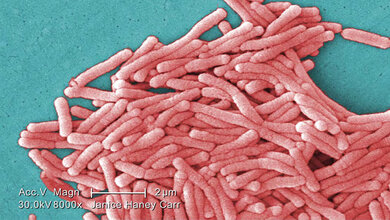 Legionärskrankheit Legionella pneumophila (SEM)
