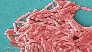 Legionella pneumophila (SEM)