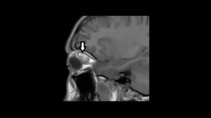 Titelbild zum Fachbeitrag Thiel, Anomalien und Normvarianten: Vaskuläre Malformation 1.6