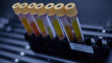 Blutserum-Proben_Charite_ArneSattler.jpg Corona Blutserum