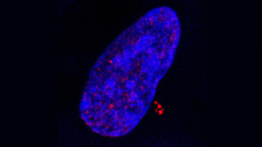 EBV infizierte Zelle