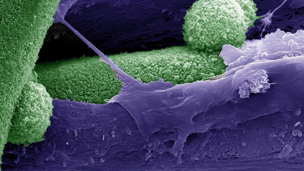 Rasterelektronenmikroskopische Aufnahme