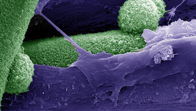 Rasterelektronenmikroskopische_Aufnahme_Die_mineralische_Phase_Uni_Freiburg.jpg Rasterelektronenmikroskopische Aufnahme