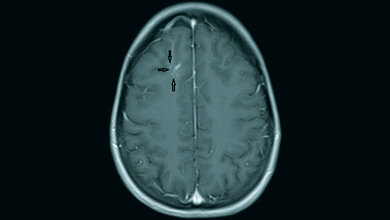Anomalien und Normvarianten
