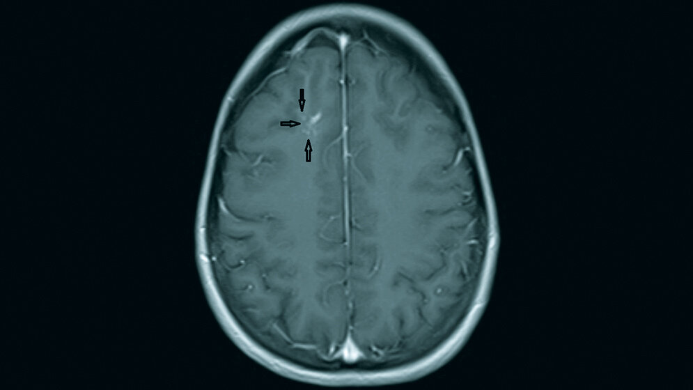 Anomalien und Normvarianten