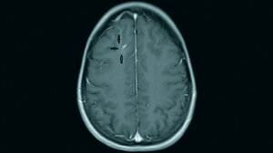 Anomalien und Normvarianten