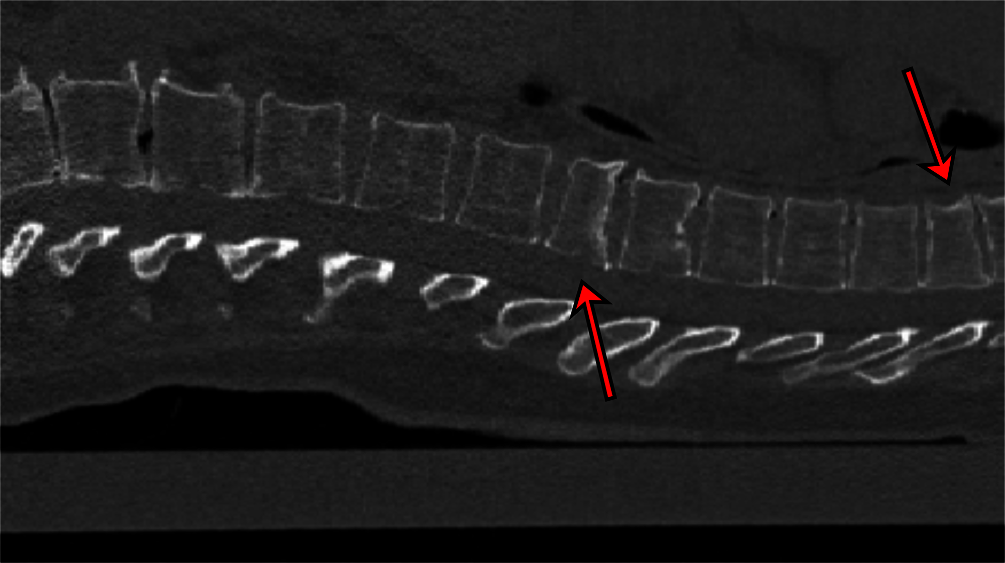 2D-Schnittbild einer CT-Aufnahme 