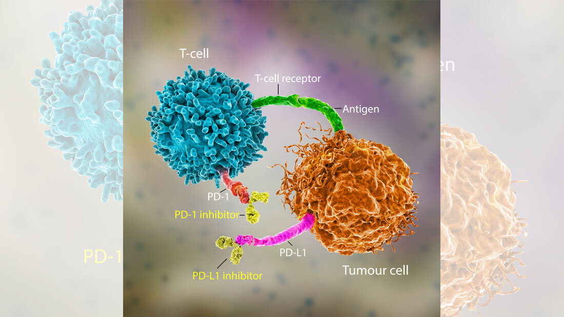 Krebs_Immuntherapie.jpg Einsatz von Immun-Checkpoint Inhibitoren (ICI)