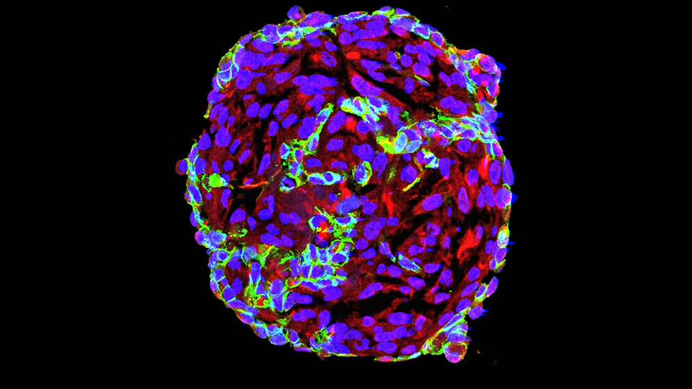 Teichert-et-al-Featured-Image.jpg Endothelzellen und Perizyten