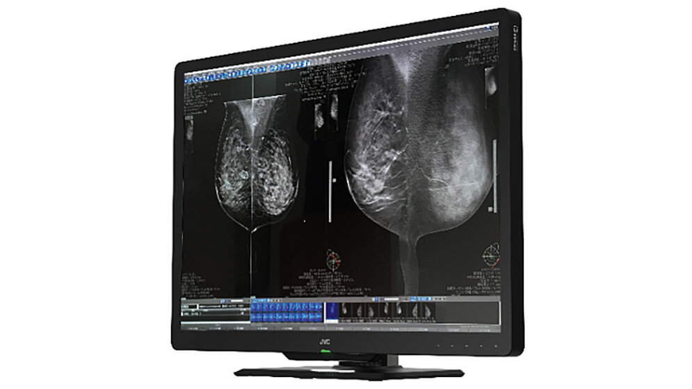 JVCKENWOOD auf dem RSNA