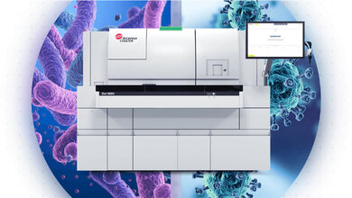 Access MeMed BV Assay 