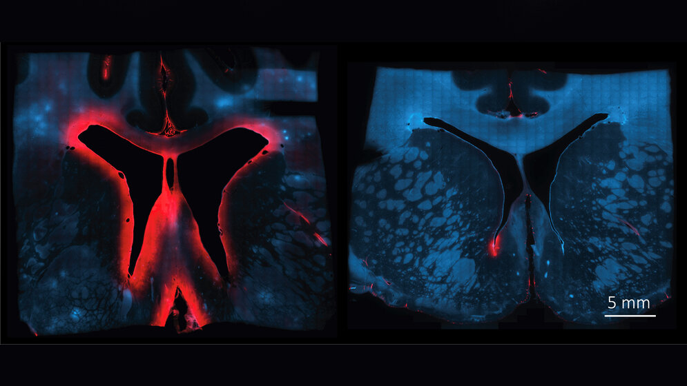 Behandlung mit Haptoglobin 