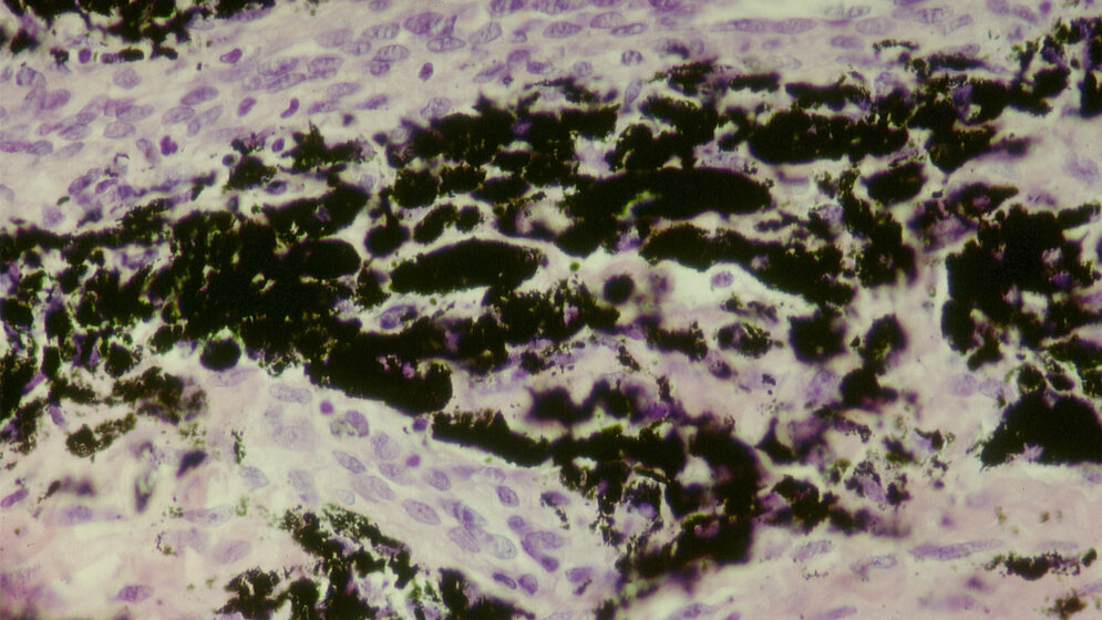 Histologischer Schnitt durch metallotisches Gewebe